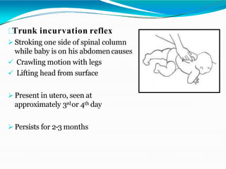 Trunk incurvation reflex
 Stroking one side of spinal column
while baby is on his abdomencauses
 Crawling motion with legs
 Lifting head from surface
 Present in utero, seen at
approximately 3rdor 4th day
 Persists for 2-3 months
 