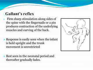 Gallant’s reflex
 Firm sharp stimulation along sides of
the spine with the fingernails or a pin
produces contraction of the underlying
muscles and curving of the back.
 Response is easily seen when theinfant
is held upright and the trunk
movement is unrestricted
 Best seen in the neonatal period and
thereafter graduallyfades.
 