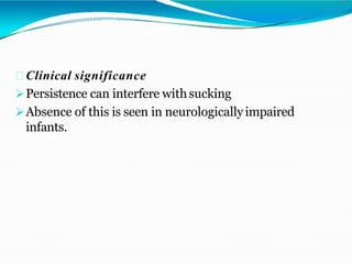 Clinical significance
Persistence can interfere withsucking
Absence of this is seen in neurologically impaired
infants.
 