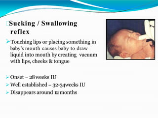 Sucking / Swallowing
reflex
Touching lips or placing something in
baby’s mouth causes baby to draw
liquid into mouth by creating vacuum
with lips, cheeks & tongue
 Onset – 28weeks IU
 Well established – 32-34weeks IU
 Disappears around 12months
 