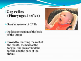 Gag reflex
(Pharyngeal reflex)
 Seen in 19weeks of IU life
 Reflex contraction of the back
of the throat
 Evoked by touching the roof of
the mouth, the back of the
tongue, the area around the
tonsils and the back of the
throat
 