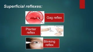 Superficial reflexes:
Gag reflex
Planter
reflex
Blinking
reflex
 