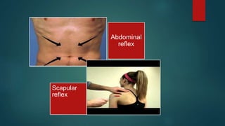 Abdominal
reflex
Scapular
reflex
 