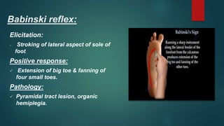 Babinski reflex:
Elicitation:
 Stroking of lateral aspect of sole of
foot.
Positive response:
 Extension of big toe & fanning of
four small toes.
Pathology:
 Pyramidal tract lesion, organic
hemiplegia.
 