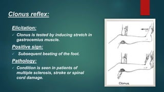 Clonus reflex:
Elicitation:
 Clonus is tested by inducing stretch in
gastrocemius muscle.
Positive sign:
 Subsequent beating of the foot.
Pathology:
 Condition is seen in patients of
multiple sclerosis, stroke or spinal
cord damage.
 