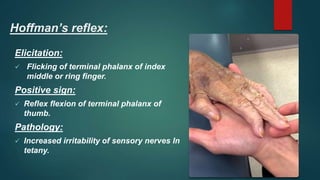 Hoffman’s reflex:
Elicitation:
 Flicking of terminal phalanx of index
middle or ring finger.
Positive sign:
 Reflex flexion of terminal phalanx of
thumb.
Pathology:
 Increased irritability of sensory nerves In
tetany.
 