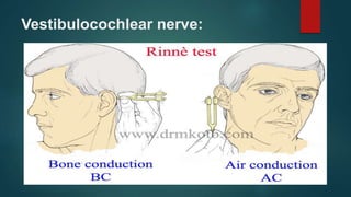 Vestibulocochlear nerve:
 