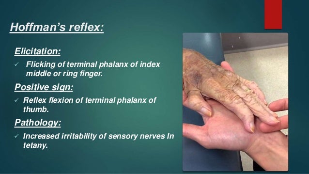 Reflexes And Cranial Nerves