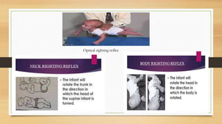 Optical righting reflex
 