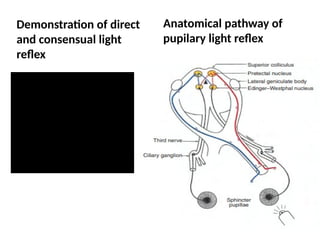 Light Reflex Example The ocular reflexes in ophthalmology.pptx
