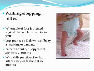  Walking/stepping
reflex
 When sole of foot is pressed
against the couch, baby tries to
walk
 Legs prance up & down as if baby
is walking or dancing
 Present at birth, disappears at
approx 2-4 months
 With daily practice of reflex,
infants may walk alone at 10
months
 