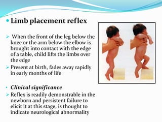  Limb placement reflex
 When the front of the leg below the
knee or the arm below the elbow is
brought into contact with the edge
of a table, child lifts the limbs over
the edge
 Present at birth, fades away rapidly
in early months of life
• Clinical significance
 Reflex is readily demonstrable in the
newborn and persistent failure to
elicit it at this stage, is thought to
indicate neurological abnormality
 