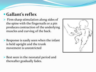  Gallant’s reflex
 Firm sharp stimulation along sides of
the spine with the fingernails or a pin
produces contraction of the underlying
muscles and curving of the back.
 Response is easily seen when the infant
is held upright and the trunk
movement is unrestricted
 Best seen in the neonatal period and
thereafter gradually fades.
 