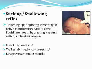  Sucking / Swallowing
reflex
 Touching lips or placing something in
baby’s mouth causes baby to draw
liquid into mouth by creating vacuum
with lips, cheeks & tongue
 Onset – 28 weeks IU
 Well established – 32-34weeks IU
 Disappears around 12 months
 