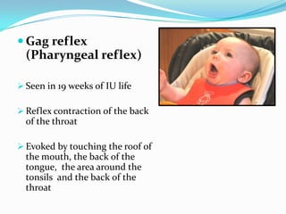 Gag reflex
(Pharyngeal reflex)
 Seen in 19 weeks of IU life
 Reflex contraction of the back
of the throat
 Evoked by touching the roof of
the mouth, the back of the
tongue, the area around the
tonsils and the back of the
throat
 