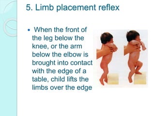 5. Limb placement reflex
 When the front of
the leg below the
knee, or the arm
below the elbow is
brought into contact
with the edge of a
table, child lifts the
limbs over the edge
 