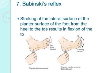 7. Babinski’s reflex
 Stroking of the lateral surface of the
planter surface of the foot from the
heel to the toe results in flexion of the
toe.
 
