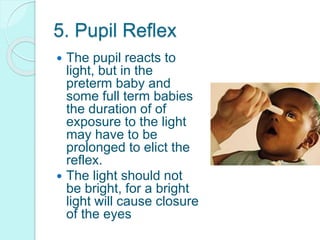 5. Pupil Reflex
 The pupil reacts to
light, but in the
preterm baby and
some full term babies
the duration of of
exposure to the light
may have to be
prolonged to elict the
reflex.
 The light should not
be bright, for a bright
light will cause closure
of the eyes
 