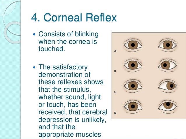 Corneal Reflexes corneal-reflexes