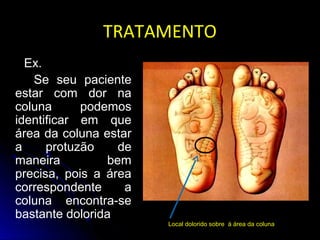 TRATAMENTOTRATAMENTO
Ex.
Se seu paciente
estar com dor na
coluna podemos
identificar em que
área da coluna estar
a protuzão de
maneira bem
precisa, pois a área
correspondente a
coluna encontra-se
bastante dolorida
Local dolorido sobre à área da coluna
 