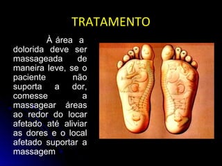 TRATAMENTOTRATAMENTO
À área a
dolorida deve ser
massageada de
maneira leve, se o
paciente não
suporta a dor,
comesse a
massagear áreas
ao redor do locar
afetado até aliviar
as dores e o local
afetado suportar a
massagem
 