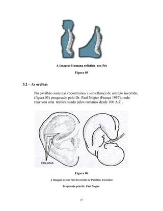 A Imagem Humana refletida nos Pés
Figura 05
3.2 – As orelhas
No pavilhão auricular encontramos a semelhança de um feto invertido,
(figura 03) pesquisado pelo Dr. Paul Nogier (França 1957), onde
reavivou uma técnica usada pelos romanos desde 100 A.C .
Figura 06
A Imagem de um Feto Invertido no Pavilhão Auricular
Pesquisado pelo Dr. Paul Nogier
27
 