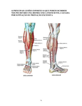 4) PRINCIPAIS LESÕES ESPORTIVAS QUE PODEM OCORRER
NOS PÉS DEVIDO UMA BIOMECÂNICA INEFICIENTE, CAUSADA
POR SUPINAÇÃO OU PRONAÇÃO EXCESSIVA
70
 