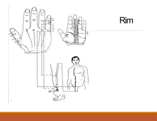 Rim
 