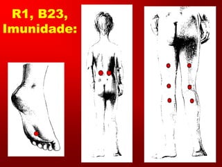 R1, B23,
Imunidade:
 