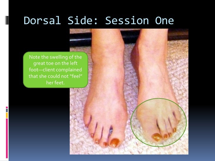 Reflexology Case Study Final