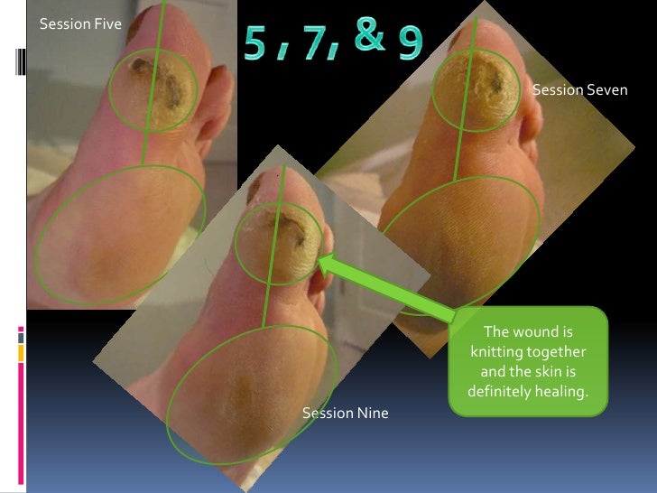 Holistic therapy case studies picture