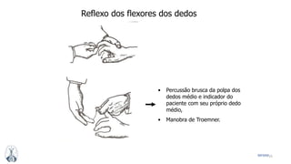 25MFMM
Reflexo dos flexores dos dedos
• Percussão brusca da polpa dos
dedos médio e indicador do
paciente com seu próprio dedo
médio,
• Manobra de Troemner.
 