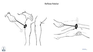 31MFMM
Reflexo Patelar
 
