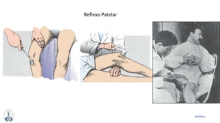 32MFMM
Reflexo Patelar
 