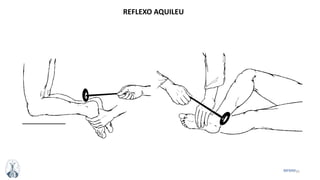 35MFMM
REFLEXO AQUILEU
 