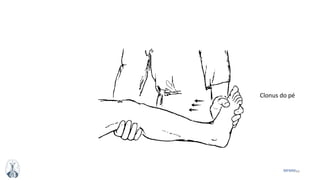 44MFMM
Clonus do pé
 