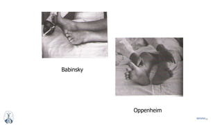 56MFMM
Babinsky
Oppenheim
 