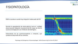 FISIOPATOLOGÍA
ERGE se produce cuando hay relajación inadecuado del EEI
Permite la regurgitación de ácido gástrico hacia el esófago
distal durante relajación transitoria del EEI mayor de 10s en
ausencia de deglución con inhibición del diafragma .
Estimulación de los quimiorreceptores e irritación, que
conlleva al desarrollo de los síntomas
Physiology and Pathogenesis of Gastroesophageal Reflux Disease Surg Clin N Am 95 (2015)
 