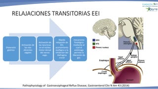 RELAJACIONES TRANSITORIAS EEI
Pathophysiology of Gastroesophageal Reflux Disease, Gastroenterol Clin N Am 43 (2014)
Distensión
gástrica
Activación de
las vías
aferentes
vágales
Activación de
las neuronas
en el núcleo
motor dorsal
del nervio
vago.
Rápida
relajación de
EEI,
acortamiento
esofágico y la
inhibición del
diafragma
crural
mecanismo
fisiológico
mediante el
cual el
estómago
permite la
liberación de
gas.
 