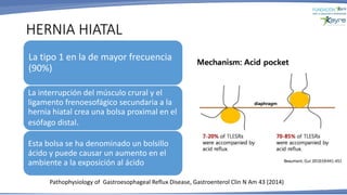 HERNIA HIATAL
Pathophysiology of Gastroesophageal Reflux Disease, Gastroenterol Clin N Am 43 (2014)
La tipo 1 en la de mayor frecuencia
(90%)
La interrupción del músculo crural y el
ligamento frenoesofágico secundaria a la
hernia hiatal crea una bolsa proximal en el
esófago distal.
Esta bolsa se ha denominado un bolsillo
ácido y puede causar un aumento en el
ambiente a la exposición al ácido
 
