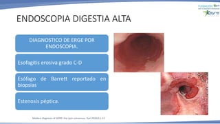 ENDOSCOPIA DIGESTIA ALTA
Modern diagnosis of GERD: the Lyon consensus. Gut 2018;0:1-12
DIAGNOSTICO DE ERGE POR
ENDOSCOPIA.
Esofagitis erosiva grado C-D
Esófago de Barrett reportado en
biopsias
Estenosis péptica.
 