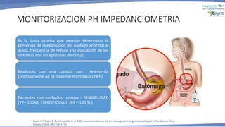 MONITORIZACION PH IMPEDANCIOMETRIA
Es la única prueba que permite determinar la
presencia de la exposición del esófago anormal al
ácido, frecuencia de reflujo y la asociación de los
síntomas con los episodios de reflujo
Realizado con una capsula con telemetría
(normalmente 48 h) o catéter transnasal (24 h)
Pacientes con esofagitis erosiva - SENSIBILIDAD
(77– 100%) ESPECIFICIDAD (85 – 100 % )
Fuchs KH, Babic B, Breithaupt W, et al. EAES recommendations for the management of gastroesophageal reflux disease. Surg
Endosc (2014) 28:1753–1773
 
