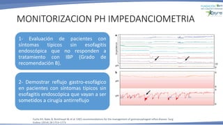 MONITORIZACION PH IMPEDANCIOMETRIA
Fuchs KH, Babic B, Breithaupt W, et al. EAES recommendations for the management of gastroesophageal reflux disease. Surg
Endosc (2014) 28:1753–1773
1- Evaluación de pacientes con
síntomas típicos sin esofagitis
endoscópica que no responden a
tratamiento con IBP (Grado de
recomendación B).
2- Demostrar reflujo gastro-esofágico
en pacientes con síntomas típicos sin
esofagitis endoscópica que vayan a ser
sometidos a cirugía antirreflujo
 