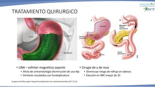TRATAMIENTO QUIRURGICO
• Cirugía de y de roux
• Disminuye riesgo de reflujo en obesos.
• Elección en IMC mayor de 35
• LINX – esfínter magnético soporte
• Alivio de sintomatología disminución de uso ibp
• Similares resultados con fundoplicatura
Surgical antireflux option beyond fundoplication Curr Gastroenterol Rep 2017 19.35
 