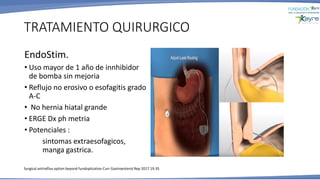 TRATAMIENTO QUIRURGICO
EndoStim.
• Uso mayor de 1 año de innhibidor
de bomba sin mejoria
• Reflujo no erosivo o esofagitis grado
A-C
• No hernia hiatal grande
• ERGE Dx ph metria
• Potenciales :
sintomas extraesofagicos,
manga gastrica.
•
Surgical antireflux option beyond fundoplication Curr Gastroenterol Rep 2017 19.35
 