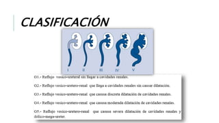 CLASIFICACIÓN
 