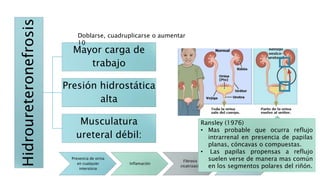 Hidroureteronefrosis
Mayor carga de
trabajo
Presión hidrostática
alta
Musculatura
ureteral débil:
Doblarse, cuadruplicarse o aumentar
10
Dilatación y estasis
Presencia de orina
en cualquier
intersticio
Inflamación
Fibrosis y
cicatrización
Cambios
parenquimatosos
Nefropatía
por reflujo
Ransley (1976)
• Mas probable que ocurra reflujo
intrarrenal en presencia de papilas
planas, cóncavas o compuestas.
• Las papilas propensas a reflujo
suelen verse de manera mas común
en los segmentos polares del riñón.
 