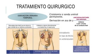 TRATAMIENTO QUIRURGICO
Cistotomía o sonda uretral
permanente.
Derivación en asa de piel.
DERIVACION URINARIA
TEMPORAL
DERIVACION URINARIA
PERMANENTE
 Ureterovesicoplastia
 Derivación tipo de Bricker.
 Derivación ureterocutánea
 