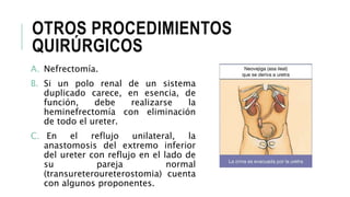 OTROS PROCEDIMIENTOS
QUIRÚRGICOS
A. Nefrectomía.
B. Si un polo renal de un sistema
duplicado carece, en esencia, de
función, debe realizarse la
heminefrectomía con eliminación
de todo el ureter.
C. En el reflujo unilateral, la
anastomosis del extremo inferior
del ureter con reflujo en el lado de
su pareja normal
(transureteroureterostomia) cuenta
con algunos proponentes.
 