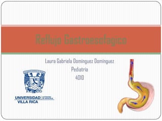 Laura Gabriela Domínguez Domínguez
Pediatría
4010
Reflujo Gastroesofagico
 